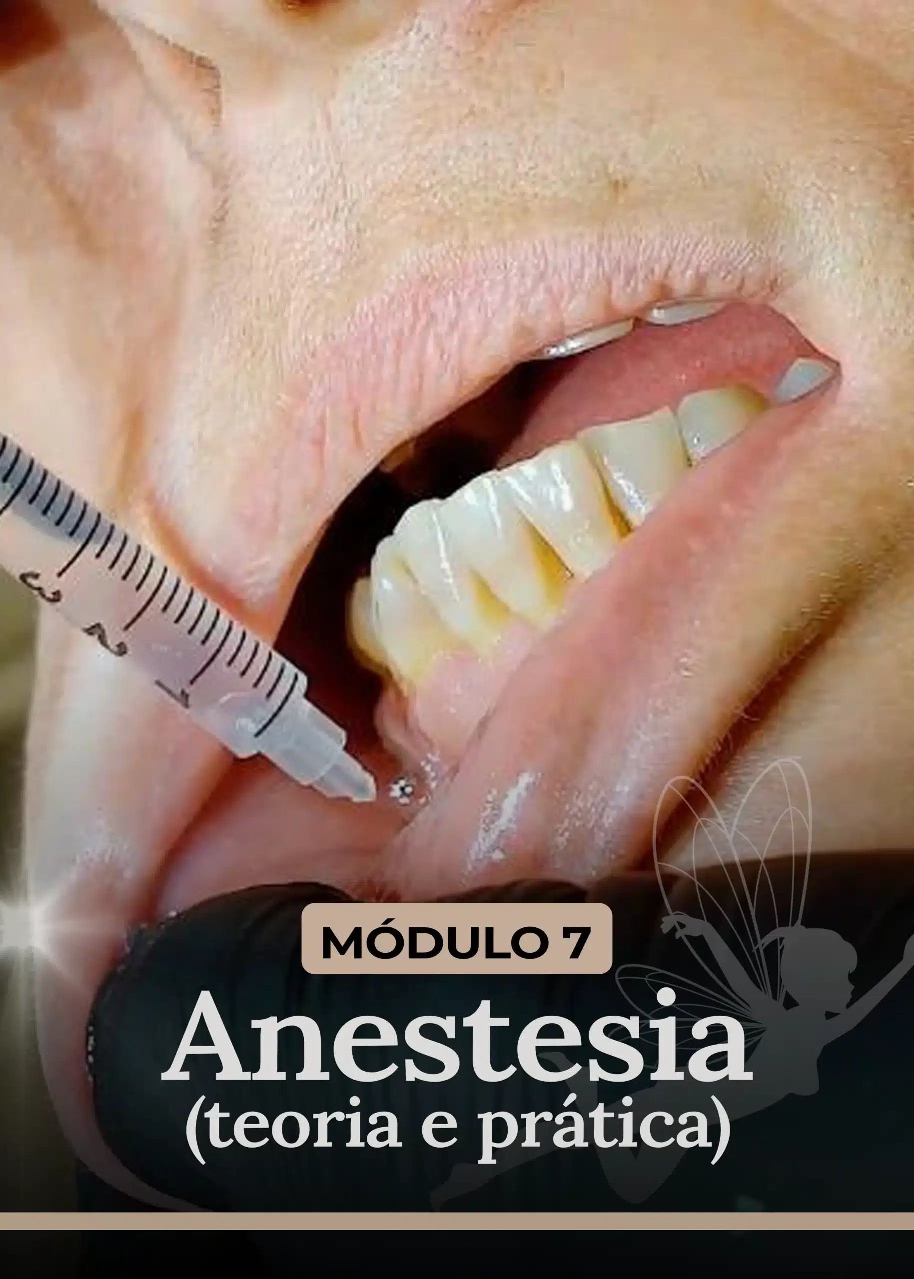 Módulo 7 - Anestesia (teoria e prática)